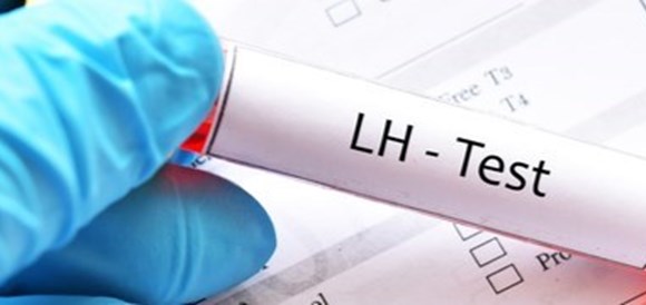 בדיקת Luteinizing Hormone) LH) - תמונה